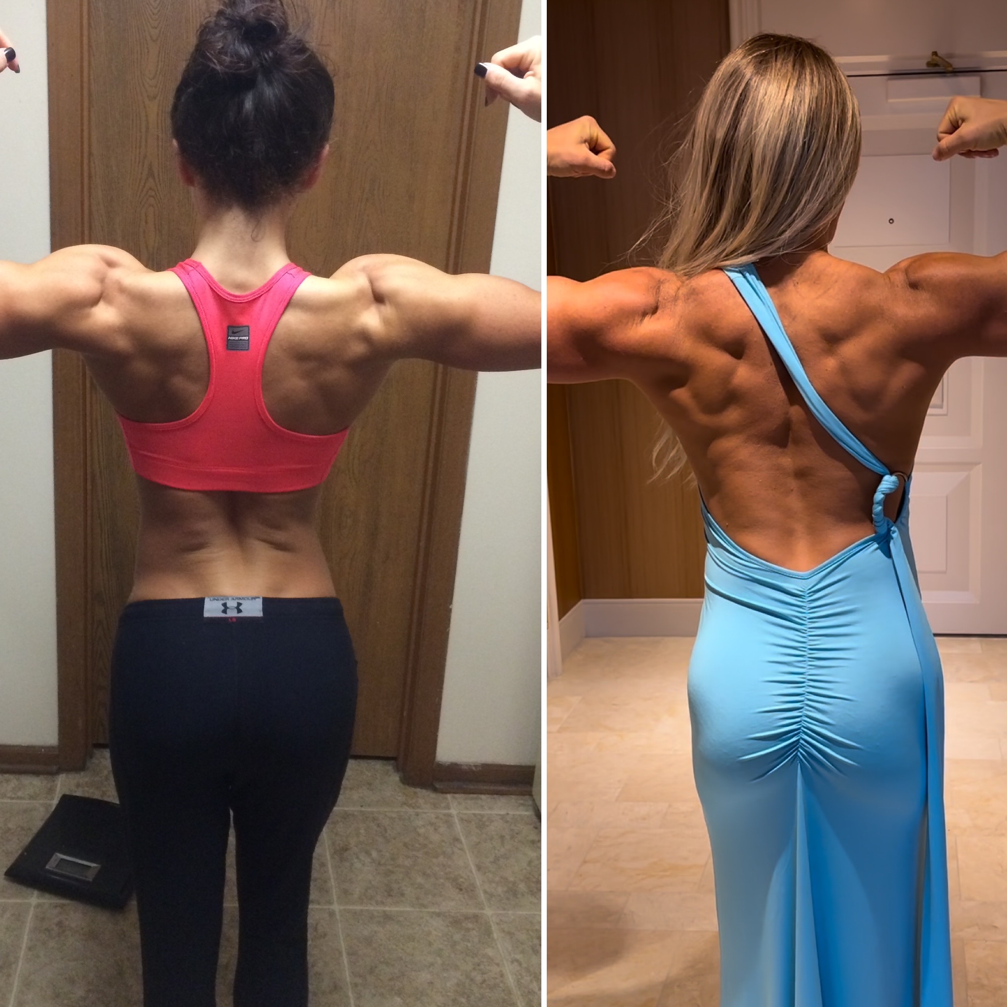 How I Improved My Scoliosis